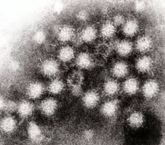 Norovirus Infects 200 at Catered Event